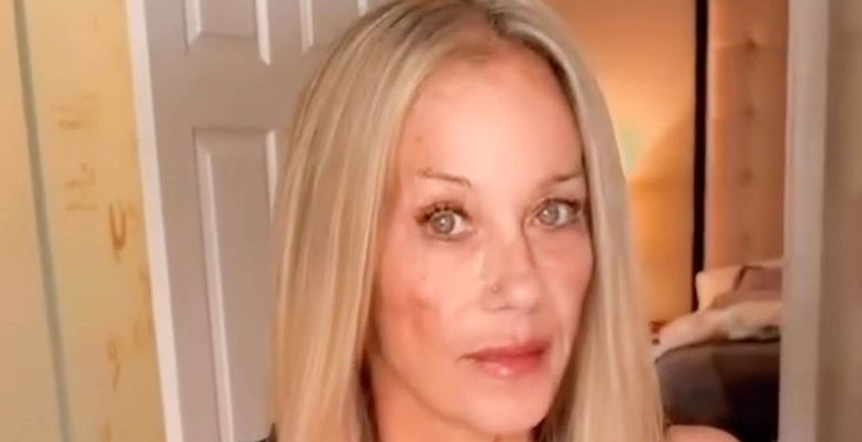 Christina Applegate Shares First Video Following Months-Long Hospitalization: ‘Love to You All Out There’