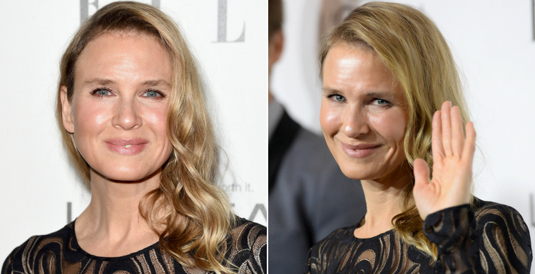 Renee Zellweger chip