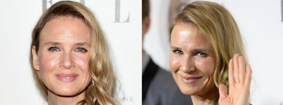 Renee Zellweger chip