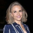 Brooke Mueller has some 'Severe Bruising' on her chin as she was seen leaving dinner at 'Craigs' Restaurant in West Hollywood, CA