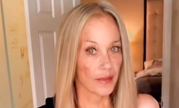 Christina Applegate Shares First Video Following Months-Long Hospitalization: ‘Love to You All Out There’
